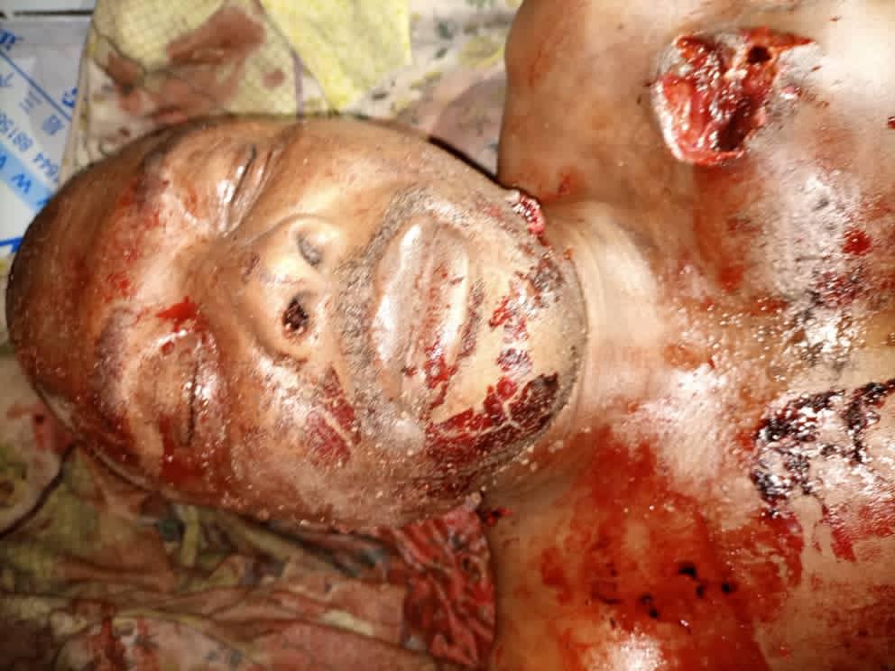 REMAINS OF KING (CHIEF) FRANCIS