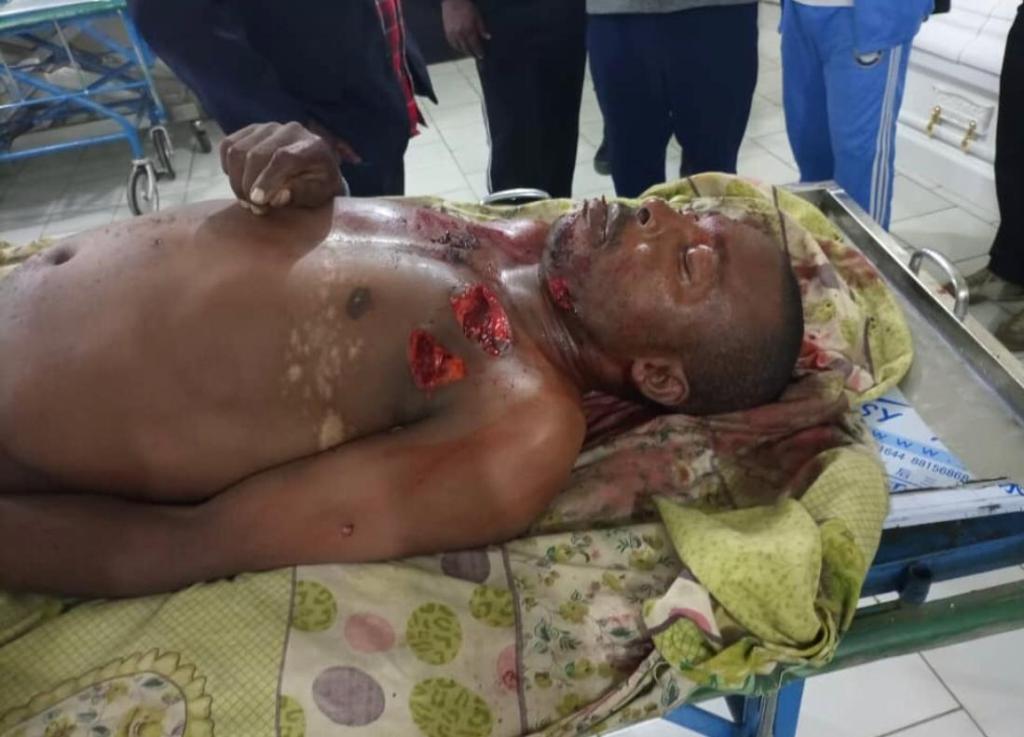 REMAINS OF KING (CHIEF) FRANCIS